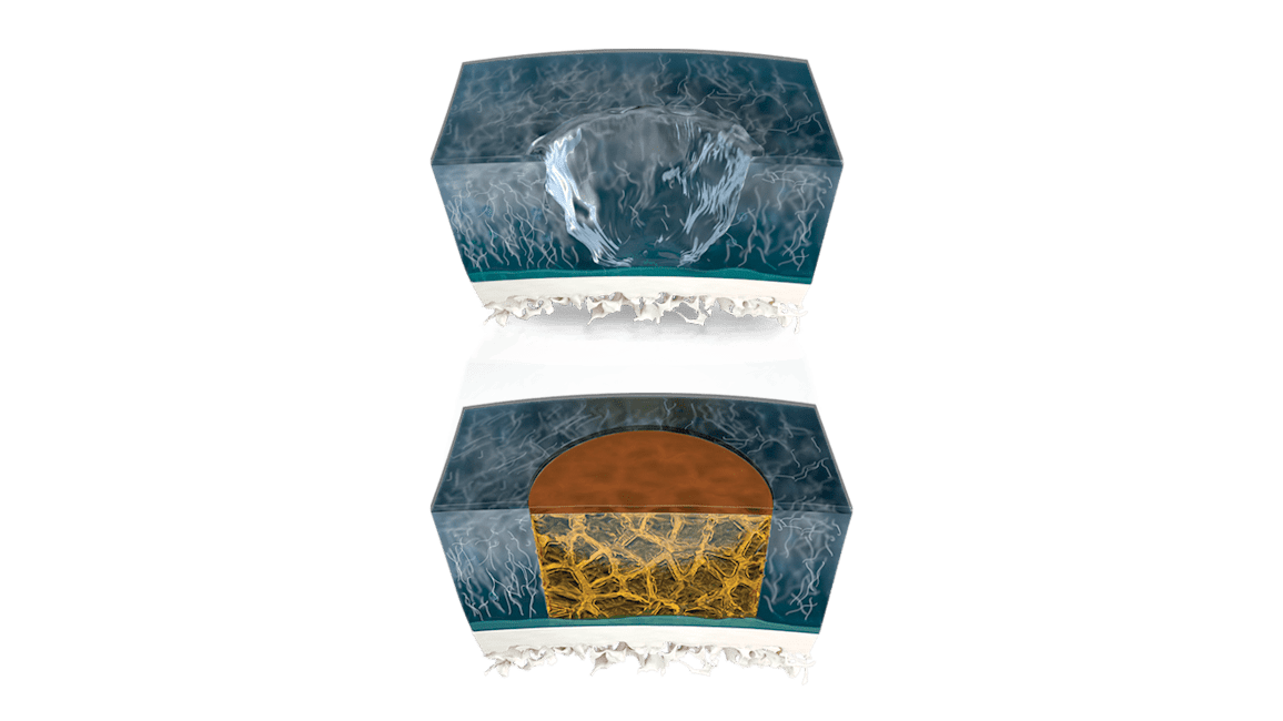 Arthrex - Orthobiologics